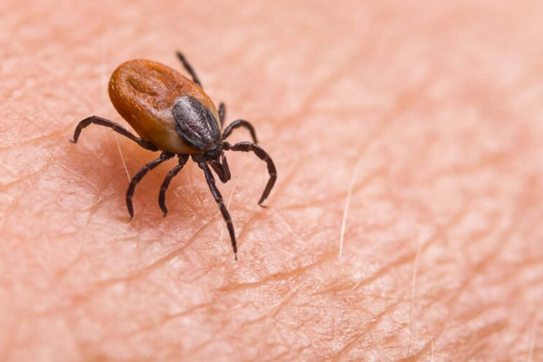A tick on a person's skin, removed by ELEET Pest Elimination